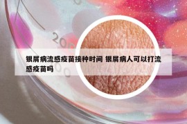 银屑病流感疫苗接种时间 银屑病人可以打流感疫苗吗