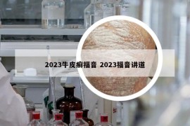 2023牛皮癣福音 2023福音讲道