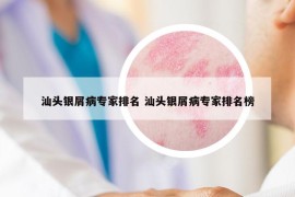 汕头银屑病专家排名 汕头银屑病专家排名榜