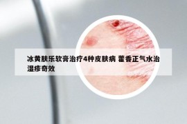 冰黄肤乐软膏治疗4种皮肤病 藿香正气水治湿疹奇效