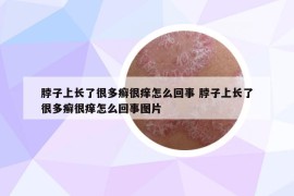 脖子上长了很多癣很痒怎么回事 脖子上长了很多癣很痒怎么回事图片