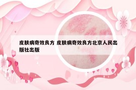 皮肤病奇效良方 皮肤病奇效良方北京人民出版社出版