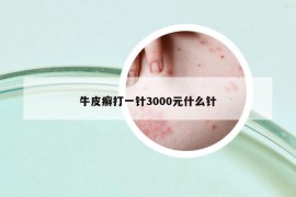 牛皮癣打一针3000元什么针