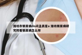 潍坊市银屑病do问孟晨星a 潍坊银屑病研究院看银屑病怎么样