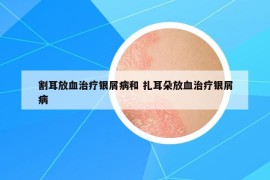 割耳放血治疗银屑病和 扎耳朵放血治疗银屑病