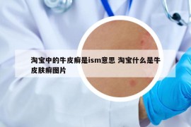 淘宝中的牛皮癣是ism意思 淘宝什么是牛皮肤癣图片