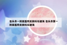 包头市一附属医院皮肤科石继海 包头市第一附属医院皮肤科石继海