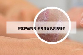 癣克抑菌乳膏 癣克抑菌乳膏说明书