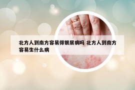 北方人到南方容易得银屑病吗 北方人到南方容易生什么病