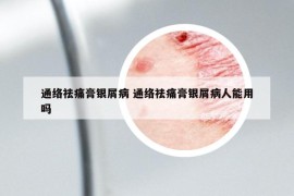 通络祛痛膏银屑病 通络祛痛膏银屑病人能用吗