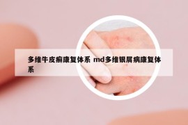 多维牛皮癣康复体系 md多维银屑病康复体系