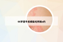 66岁患牛皮癣能吃阿维a约