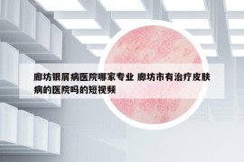 廊坊银屑病医院哪家专业 廊坊市有治疗皮肤病的医院吗的短视频