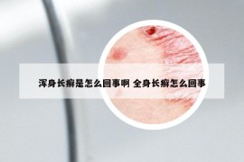 浑身长癣是怎么回事啊 全身长癣怎么回事