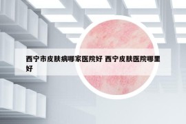 西宁市皮肤病哪家医院好 西宁皮肤医院哪里好