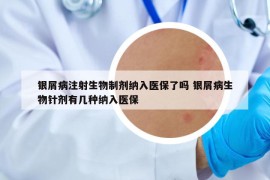 银屑病注射生物制剂纳入医保了吗 银屑病生物针剂有几种纳入医保