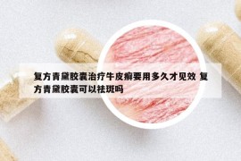 复方青黛胶囊治疗牛皮癣要用多久才见效 复方青黛胶囊可以祛斑吗