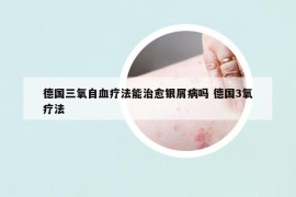 德国三氧自血疗法能治愈银屑病吗 德国3氧疗法