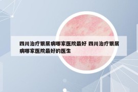 四川治疗银屑病哪家医院最好 四川治疗银屑病哪家医院最好的医生