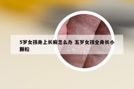 5岁女孩身上长癣怎么办 五岁女孩全身长小颗粒