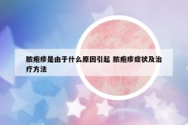 脓疱疹是由于什么原因引起 脓疱疹症状及治疗方法