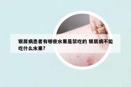 银屑病患者有哪些水果是禁吃的 银屑病不能吃什么水果?