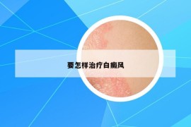 要怎样治疗白癜风