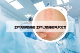 怎样克服银屑病 怎样让银屑病减少复发