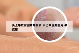 头上牛皮廨图片牛皮廨 头上牛皮廨图片 牛皮廨