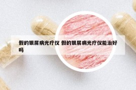 假的银屑病光疗仪 假的银屑病光疗仪能治好吗