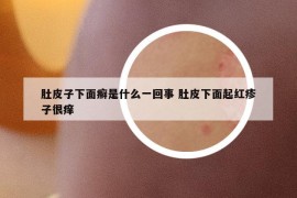 肚皮子下面癣是什么一回事 肚皮下面起红疹子很痒