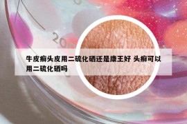 牛皮癣头皮用二硫化硒还是康王好 头癣可以用二硫化硒吗