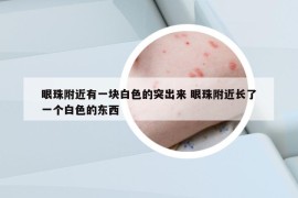 眼珠附近有一块白色的突出来 眼珠附近长了一个白色的东西