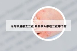 治疗银屑病去三亚 银屑病人都在三亚哪个村