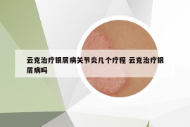 云克治疗银屑病关节炎几个疗程 云克治疗银屑病吗