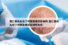 薏仁美白丸吃了对银屑病又影响吗 薏仁美白丸吃了对银屑病又影响吗女性