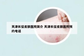 天津长征皮肤医院简介 天津长征皮肤医院预约电话