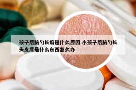 孩子后脑勺长癣是什么原因 小孩子后脑勺长头皮屑是什么东西怎么办