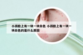 小孩脸上有一块一块白色 小孩脸上有一块一块白色的是什么原因