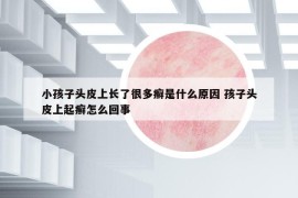 小孩子头皮上长了很多癣是什么原因 孩子头皮上起癣怎么回事