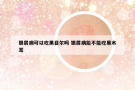 银屑病可以吃黑目尔吗 银屑病能不能吃黑木耳