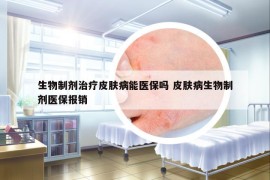 生物制剂治疗皮肤病能医保吗 皮肤病生物制剂医保报销