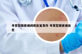 寻常型银屑病间歇反复发作 寻常型银屑病自愈