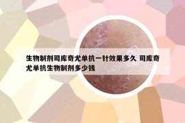 生物制剂司库奇尤单抗一针效果多久 司库奇尤单抗生物制剂多少钱