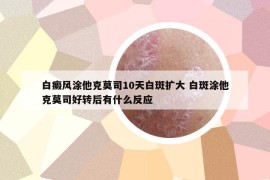 白癜风涂他克莫司10天白斑扩大 白斑涂他克莫司好转后有什么反应