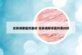 皮肤病那医院最好 皮肤病那家医院看的好