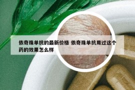 依奇珠单抗的最新价格 依奇珠单抗用过这个药的效果怎么样