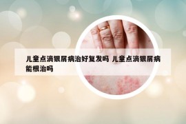 儿童点滴银屑病治好复发吗 儿童点滴银屑病能根治吗