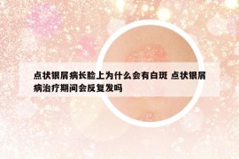 点状银屑病长脸上为什么会有白斑 点状银屑病治疗期间会反复发吗