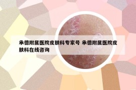 承德附属医院皮肤科专家号 承德附属医院皮肤科在线咨询